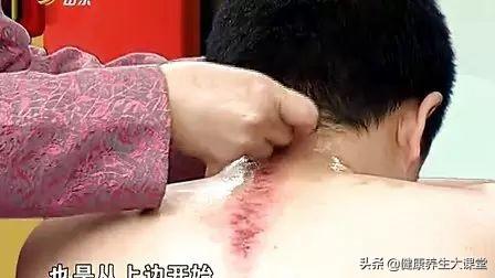 刮痧后運(yùn)動(dòng)可以嗎_刮痧后多久可以運(yùn)動(dòng)_運(yùn)動(dòng)刮痧可以后天天刮嗎